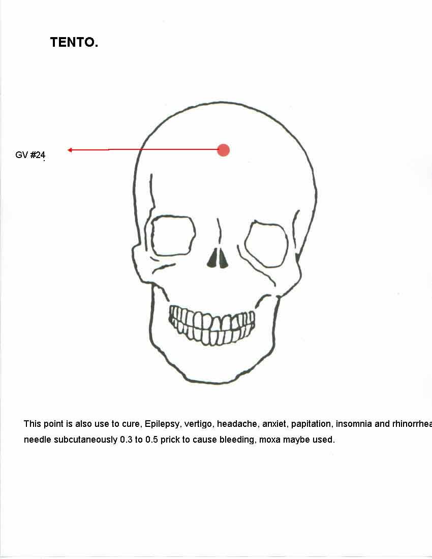 tento pressure point - top of head